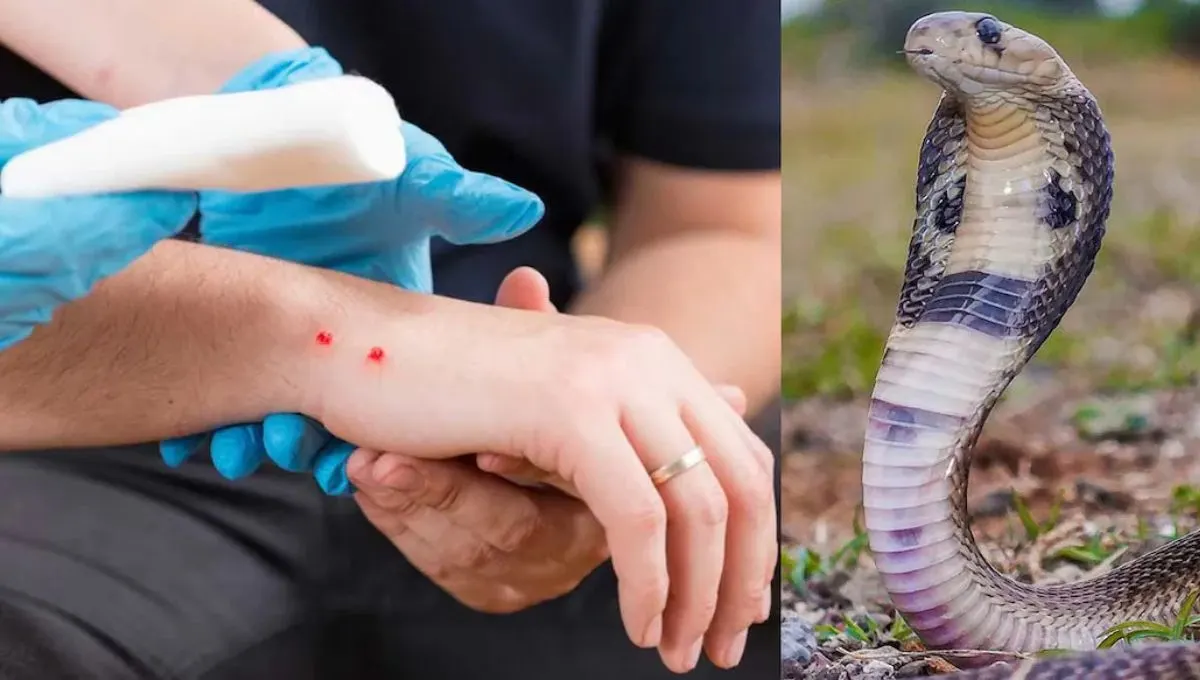 साप चावला तर घाबरू नका! नागलोकवाला गोल्डन रूलने वाचवा जीव!